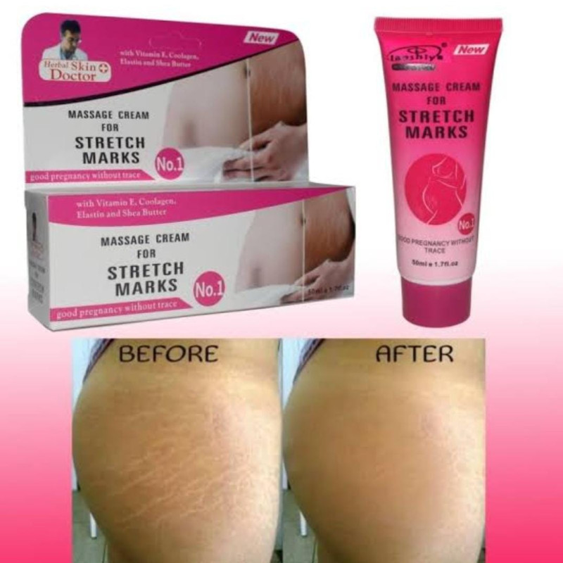 Anti stretch mark cream (imported product)
